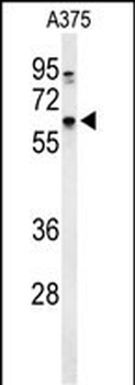 DCT Antibody (N-term)