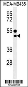 CD1E Antibody (Center)