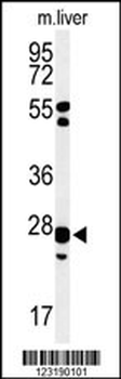GSTK1 Antibody (Center)