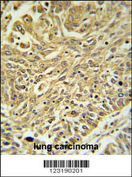 GSTK1 Antibody (Center)