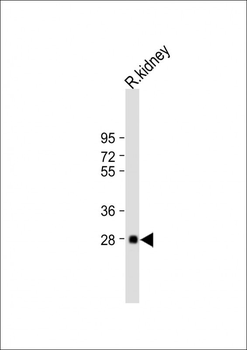 BSND Antibody (C-term)
