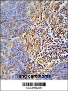 HLA-DRB5 Antibody (Center)