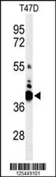 VTCN1 Antibody (Center)