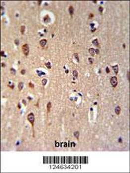 GRPR Antibody (Center)