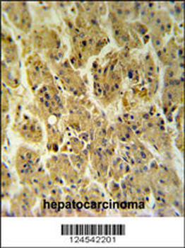NDUFS2 Antibody (Center)