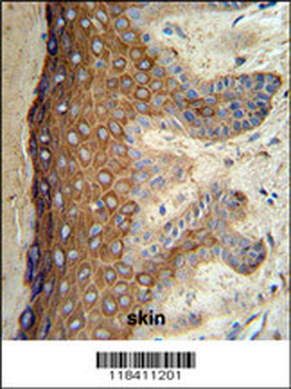 KRT1 Antibody (Center)