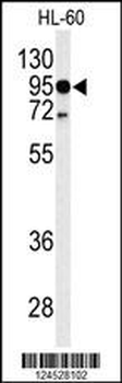 TLR4 Antibody (Center)
