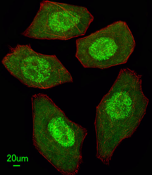 FANCC Antibody (C-term)