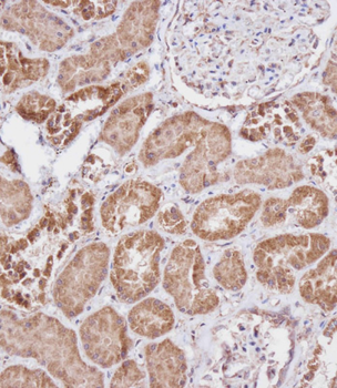 FBXL5 Antibody (N-term)