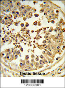 DIAPH2 Antibody (Center)