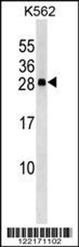 CXXC4 Antibody (C-term)