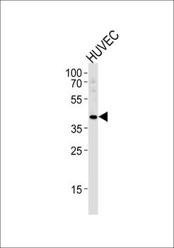 TBX1 Antibody (C-term)