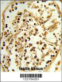 TBX1 Antibody (C-term)
