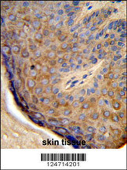 TCHP Antibody (Center)