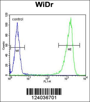 GUSB Antibody (Center)