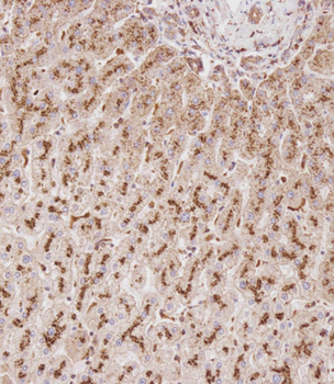 GUSB Antibody (Center)