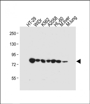 GUSB Antibody (Center)