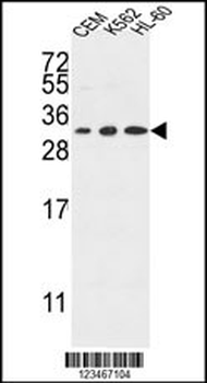 TSPAN2 Antibody (Center)