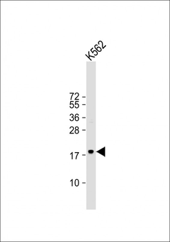TSPAN2 Antibody (Center)