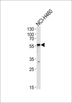 GABRA2 Antibody (C-term)