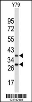 FBXO4 Antibody (Center)