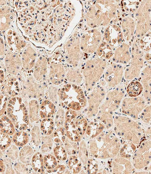 ABCF1 Antibody (C-term)