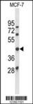 ATXN3 Antibody (Center)