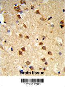 ATXN3 Antibody (Center)