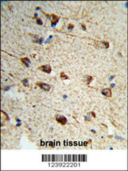 FMOD Antibody (C-term)