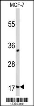 DSTN Antibody (Center)