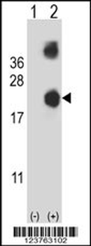 DSTN Antibody (Center)
