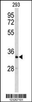 CRELD2 Antibody (C-term)