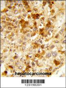 PXMP3 Antibody (Center)