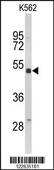 KIR3DL3 Antibody (Center)