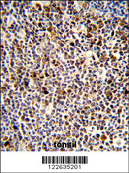 KIR3DL3 Antibody (Center)
