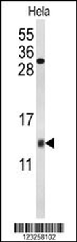 COX5A Antibody (Center)
