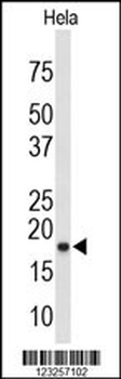 COX4I1 Antibody (N-term)