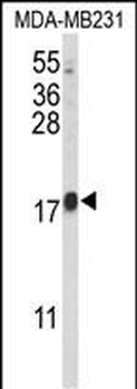 HRIHFB2025 Antibody (C-term)