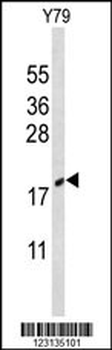 CIRBP Antibody (C-term)