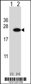 CIRBP Antibody (C-term)