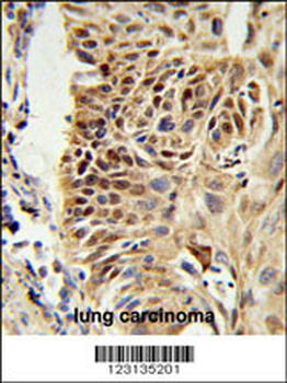 CIRBP Antibody (C-term)