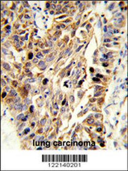 EFEMP1 Antibody (N-term)