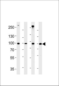 HSPCB Antibody (N-term)