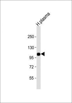 CFB Antibody (Center)