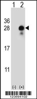 DLK2 Antibody (C-term)
