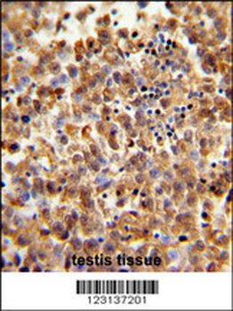 CLGN Antibody (Center)