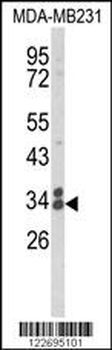CLTA Antibody (Center)
