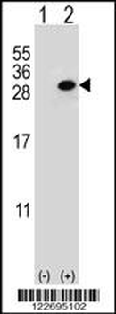 CLTA Antibody (Center)