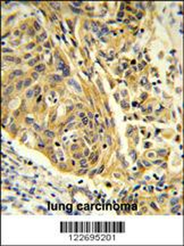 CLTA Antibody (Center)