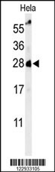 RAB8A Antibody